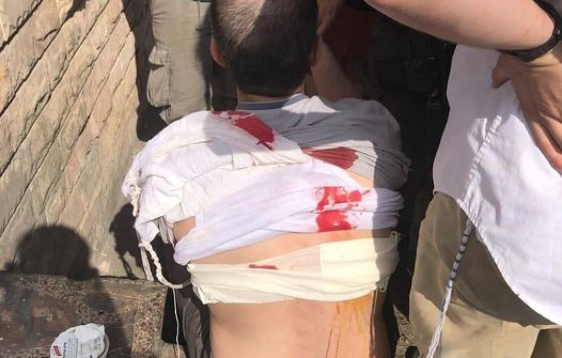 اصابة مستوطن صهيوني بعملية طعن في رام الله